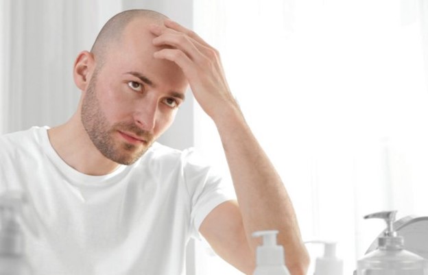 طاسی و سطح تستوسترون