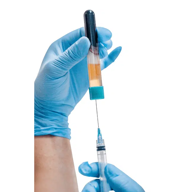 PRF (فیبرین غنی از پلاکت - PRP نسل بعدی)
