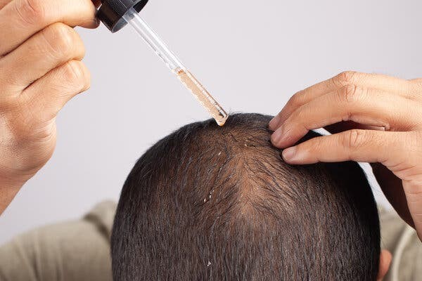 نحوه صحیح استفاده از ماینوکسیدیل در درمان ریزش مو