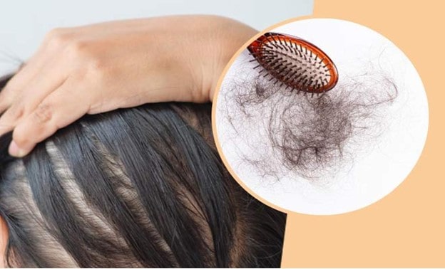 چگونه کووید 19 می‌تواند باعث ریزش مو شود؟