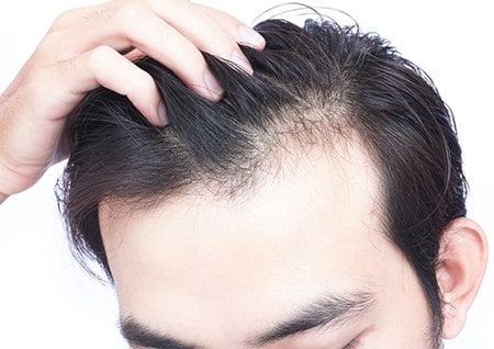 تلوژن افلوویوم چیست؟