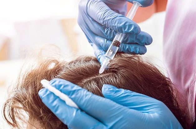 روشهای کنترل ریزش مو ناشی از جراحی