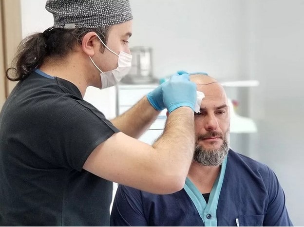 چه کسانی کاندید مناسبی برای روش کاشت FIT هستند؟